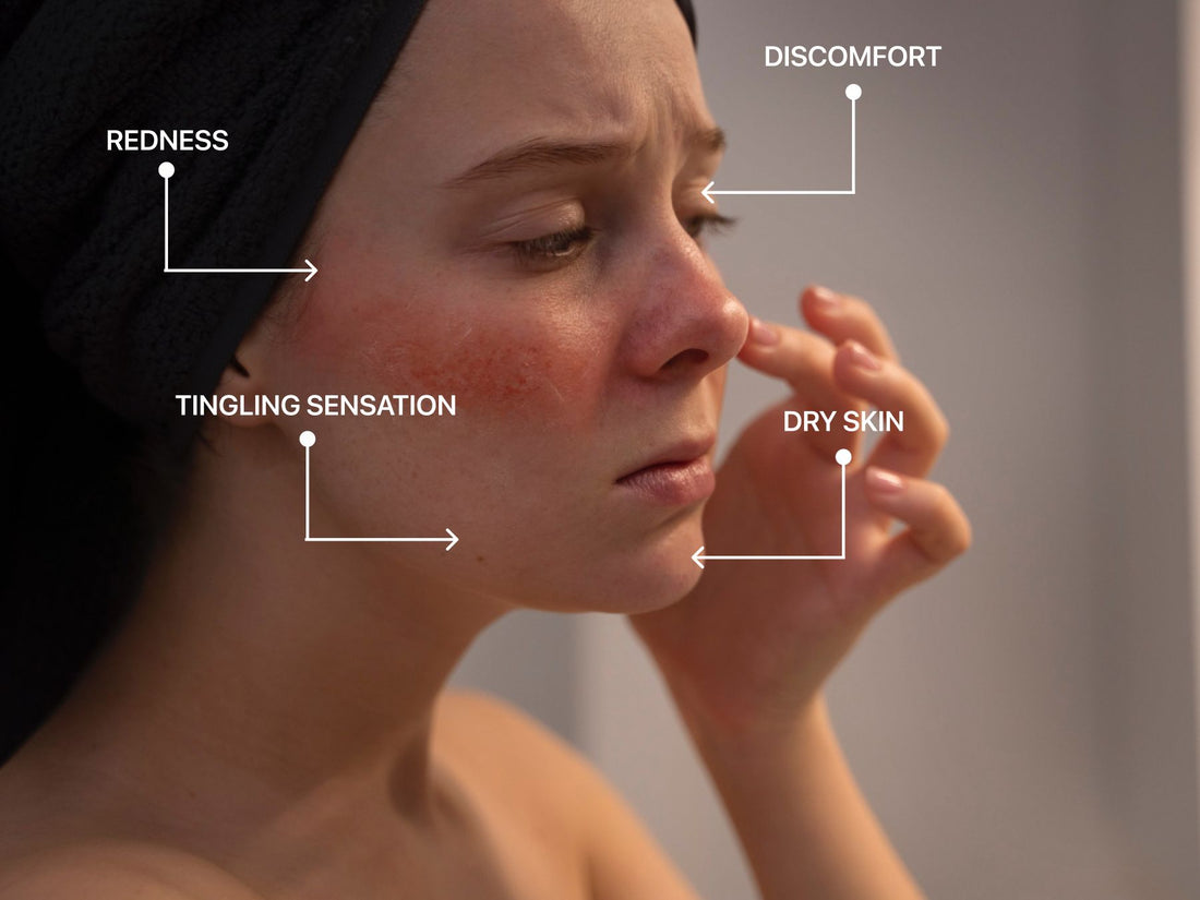 What Is Sensitive Skin and How Do I Know If I Have It? - PLUSREAL